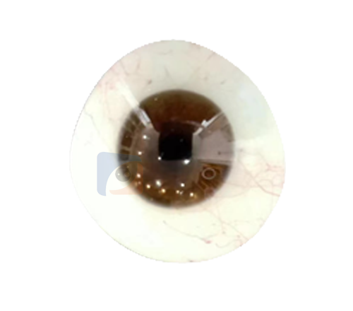 山西进口义眼定制